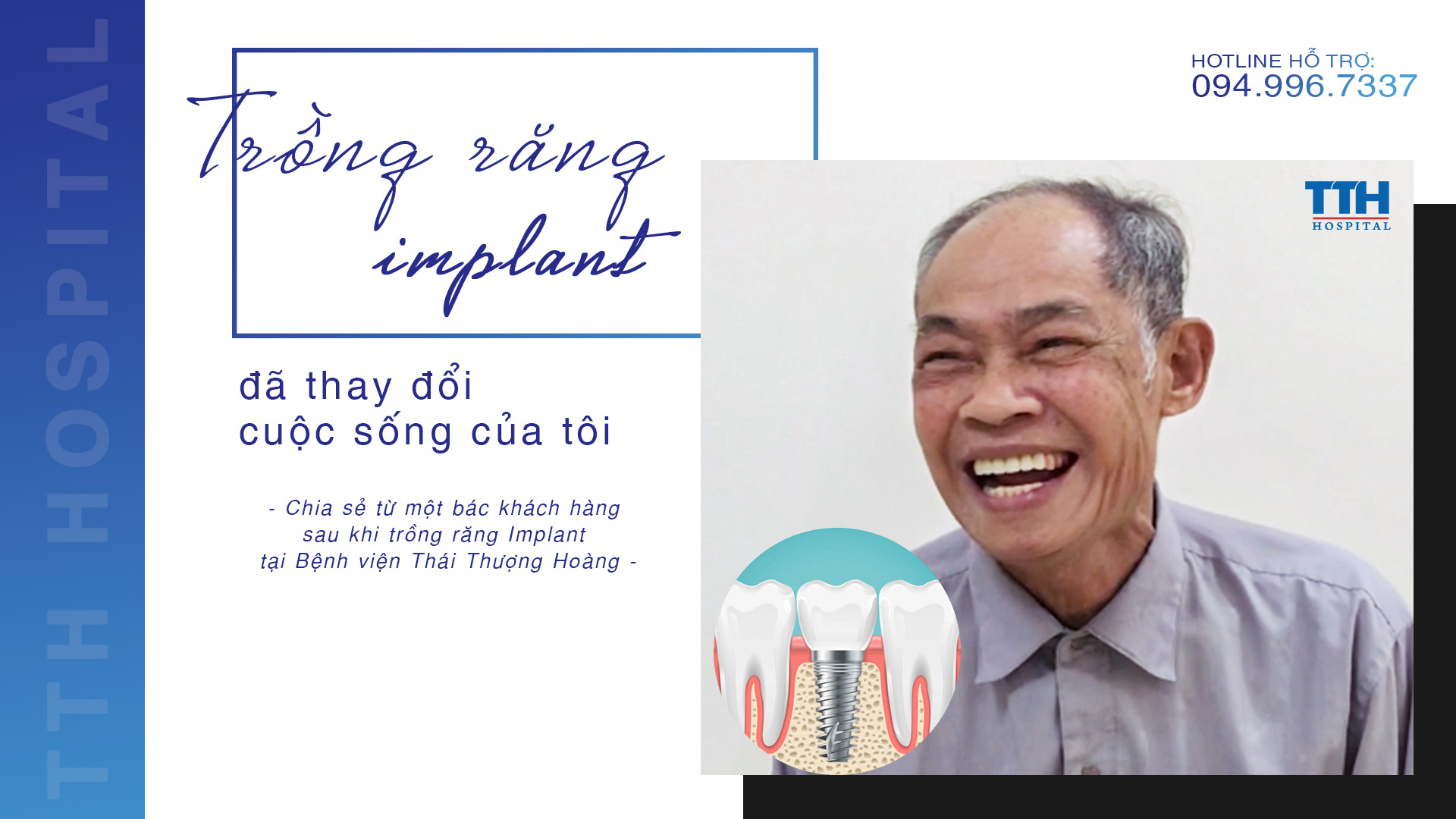 [GÓC CHIA SẺ] TRỒNG RĂNG IMPLANT ĐÃ THAY ĐỔI CUỘC SỐNG CỦA TÔI THẾ NÀO?